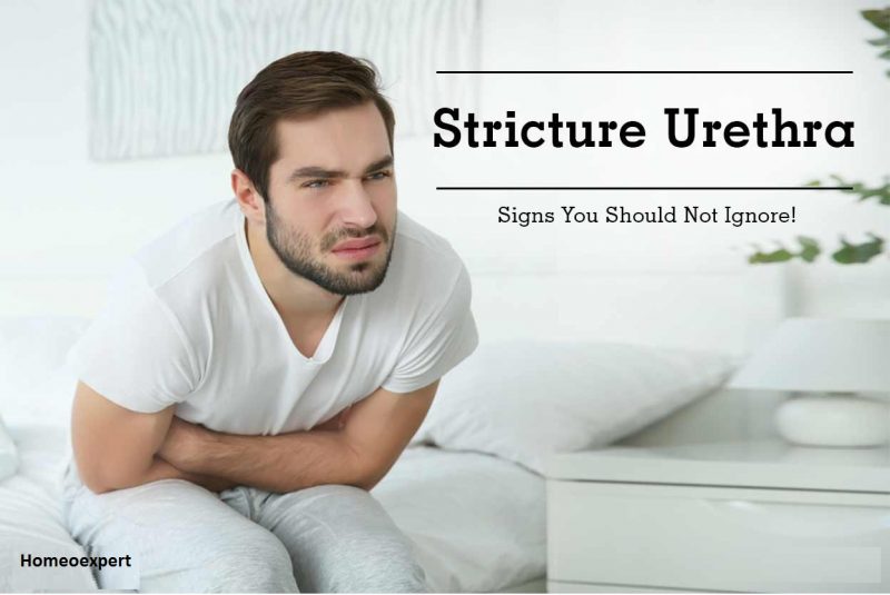 Homeopathic Medicine for Urethral Stricture