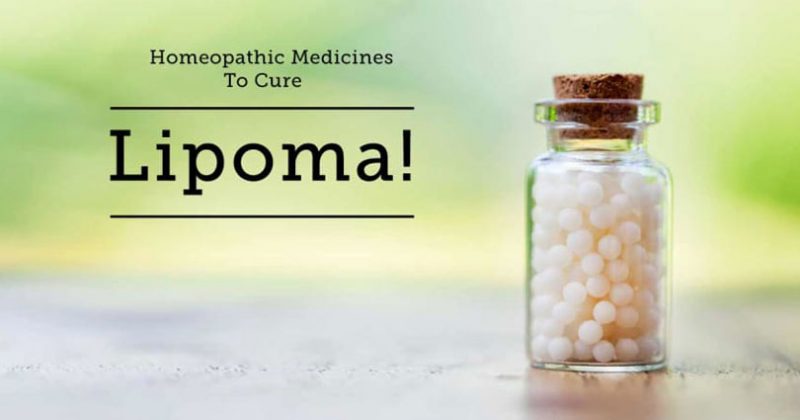 Homeopathic Medicine for Lipoma