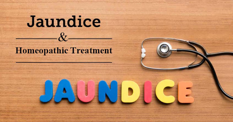 Homeopathic Medicine For Jaundice Jaundice Treatment In Homeopathy