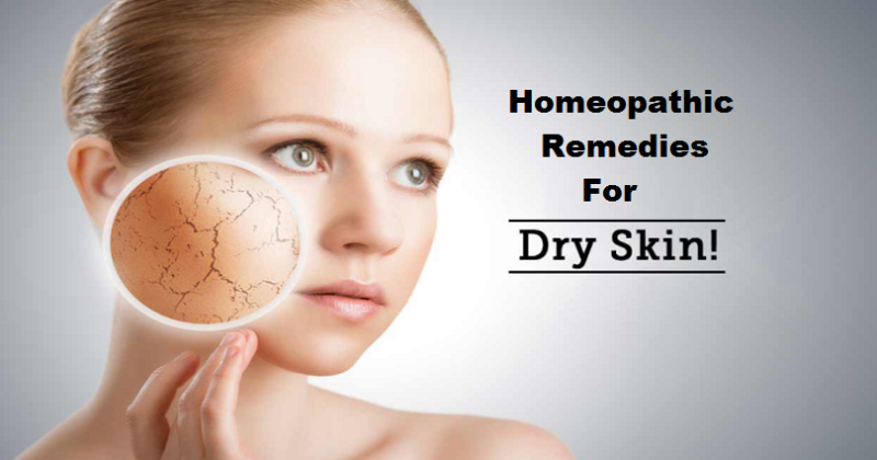 homeopathic remedies for dry skin