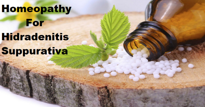 Homeopathic Treatment for Hidradenitis Suppurativa