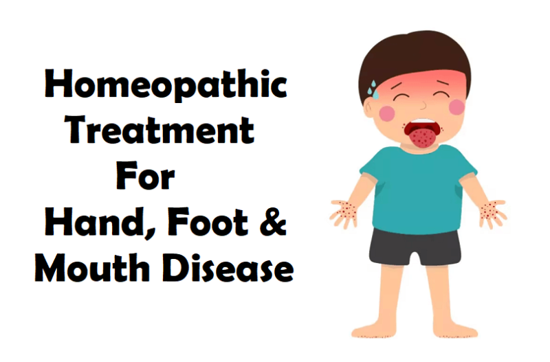 homeopathic remedies for hand foot and mouth disease