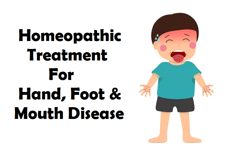 Homeopathic Treatment for Hand, Foot and Mouth Disease